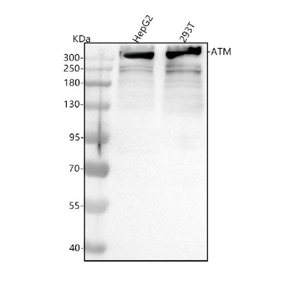 1 - Anti-ATM Monoclonal Antibody ABO14357
