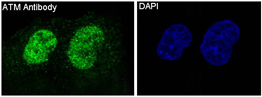 3 - Anti-ATM Monoclonal Antibody ABO14357