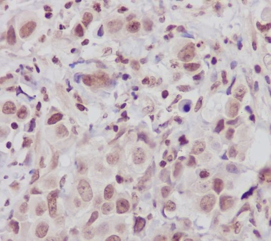 2 - Anti-ATM Monoclonal Antibody ABO14357
