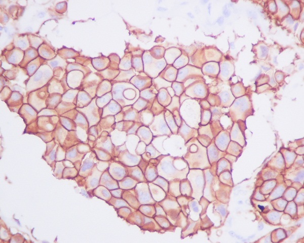2 - Anti-ErbB2 (HER2) Monoclonal Antibody ABO14358