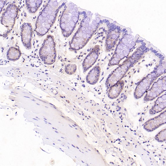 2 - Anti-ErbB2 (HER2) Monoclonal Antibody ABO14358