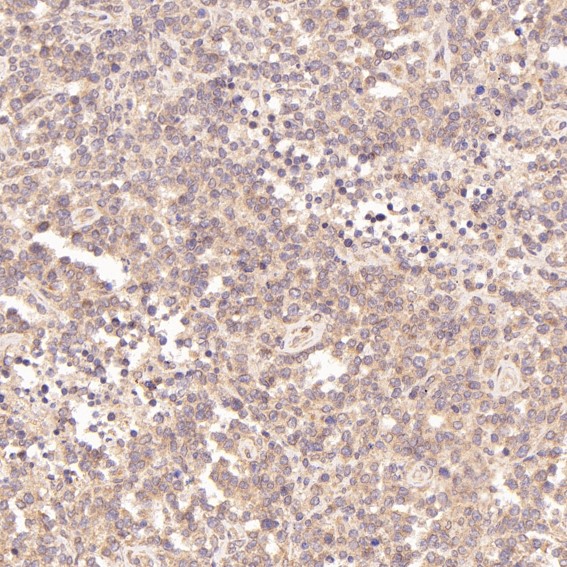 2 - Anti-ErbB2 (HER2) Monoclonal Antibody ABO14358