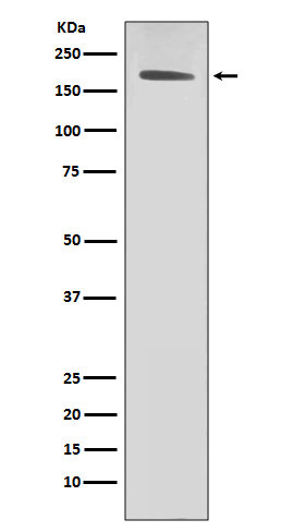 1 - Anti-ErbB2 (HER2) Monoclonal Antibody ABO14358