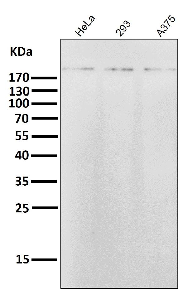 1 - Anti-ErbB2 (HER2) Monoclonal Antibody ABO14358
