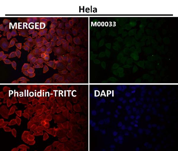 1 - Anti-Notch1 Monoclonal Antibody ABO14360