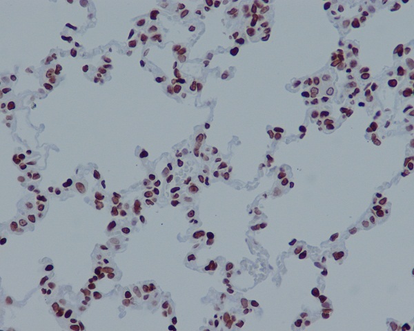 2 - Anti-Histone H4 (acetyl K16) HIST1H4A Monoclonal Antibody ABO14361