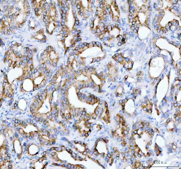 2 - Anti-JAK2 Monoclonal Antibody ABO14362