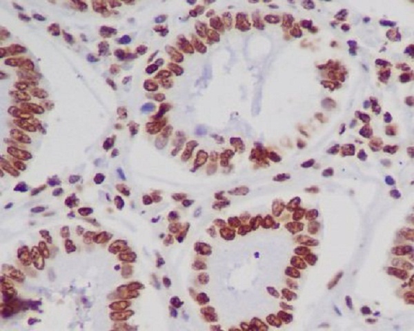 2 - Anti-Histone H4 (acetyl K5) HIST1H4A Monoclonal Antibody ABO14363