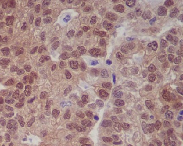 2 - Anti-p16 INK Monoclonal Antibody ABO14364