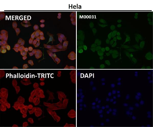 1 - Anti-CXCR4 Monoclonal Antibody ABO14365