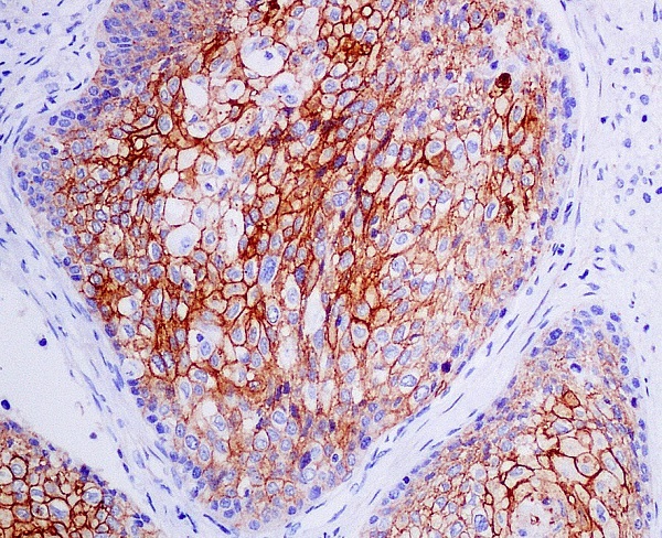 2 - Anti-CXCR4 Monoclonal Antibody ABO14365
