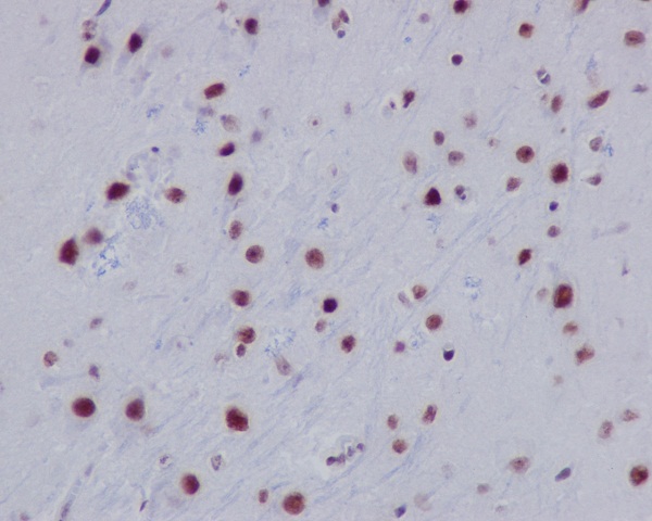 2 - Anti-Histone H2A (acetyl K9) HIST1H2AB Monoclonal Antibody ABO14367
