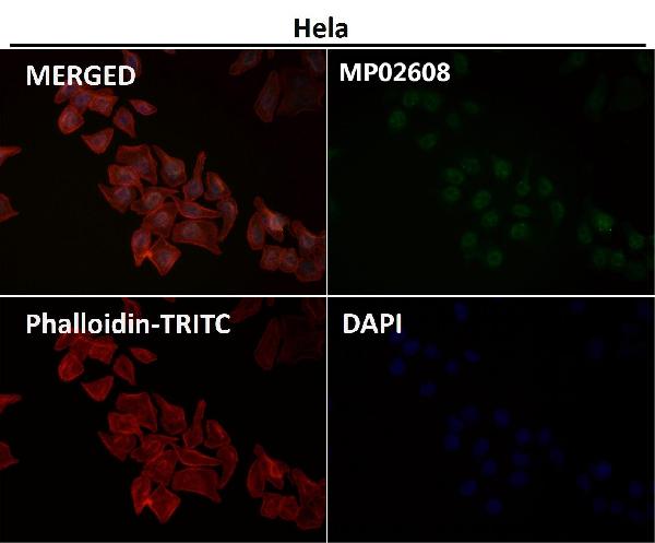 1 - Anti-Phospho-JNK1/2/3 (T183+T183+T221) MAPK8 Monoclonal Antibody ABO14368