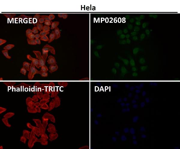 1 - Anti-Phospho-JNK1/2/3 (T183+T183+T221) MAPK8 Monoclonal Antibody ABO14368