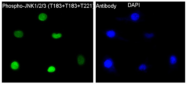 3 - Anti-Phospho-JNK1/2/3 (T183+T183+T221) MAPK8 Monoclonal Antibody ABO14368