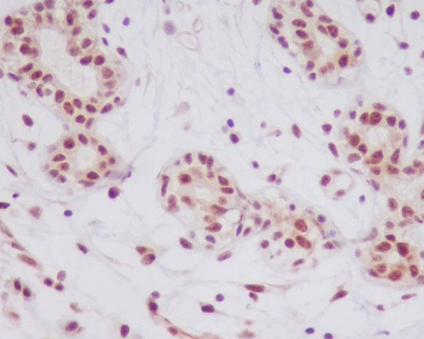 2 - Anti-Phospho-JNK1/2/3 (T183+T183+T221) MAPK8 Monoclonal Antibody ABO14368
