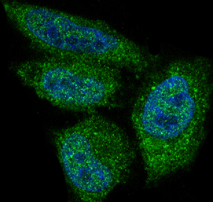 3 - Anti-AKT1 Monoclonal Antibody ABO14369
