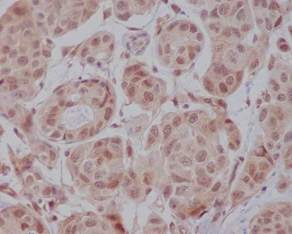 2 - Anti-AKT1 Monoclonal Antibody ABO14369
