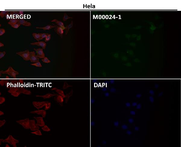 1 - Anti-AKT1 Monoclonal Antibody ABO14369