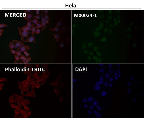 1 - Anti-AKT1 Monoclonal Antibody ABO14369