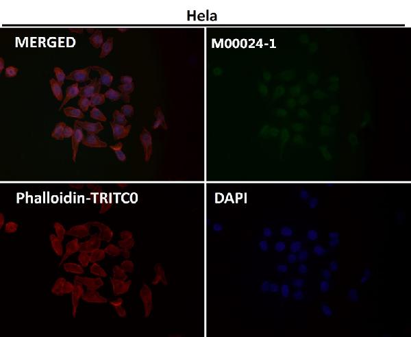 1 - Anti-AKT1 Monoclonal Antibody ABO14369