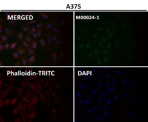 1 - Anti-AKT1 Monoclonal Antibody ABO14369