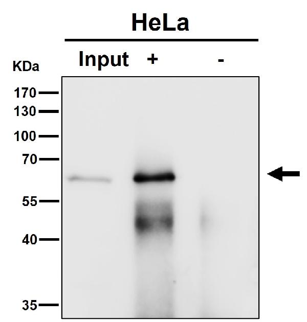 1 - Anti-AKT1 Monoclonal Antibody ABO14369