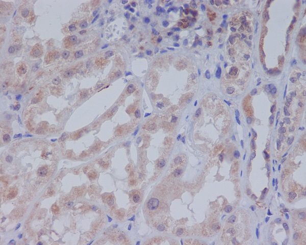 2 - Anti-Acetyl-CoA Carboxylase Monoclonal Antibody ABO14371