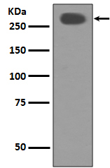 1 - Anti-Acetyl-CoA Carboxylase Monoclonal Antibody ABO14371