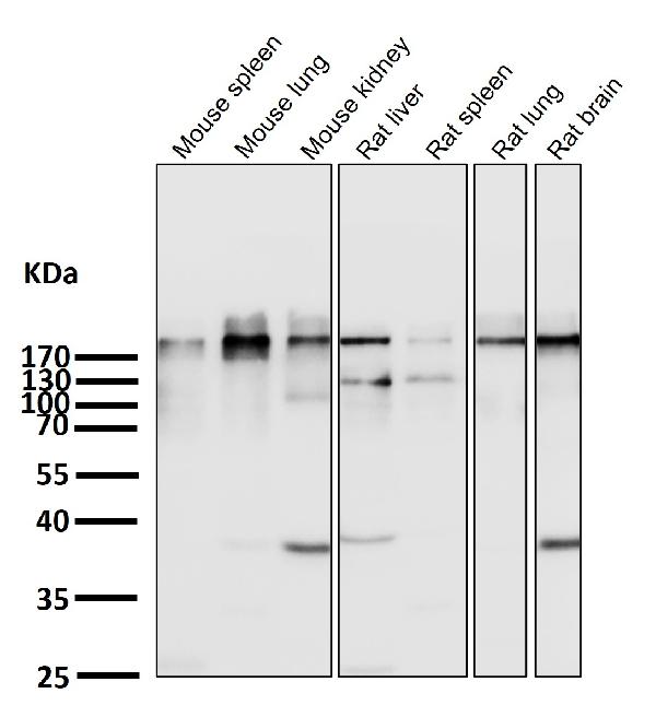 1 - Anti-Acetyl-CoA Carboxylase Monoclonal Antibody ABO14371