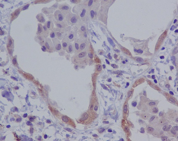 2 - Anti-NALP3 NLRP3 Rabbit Monoclonal Antibody ABO14373