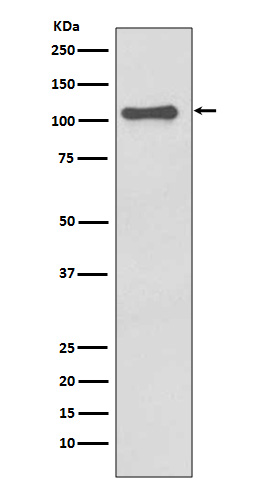 1 - Anti-NALP3 NLRP3 Rabbit Monoclonal Antibody ABO14373