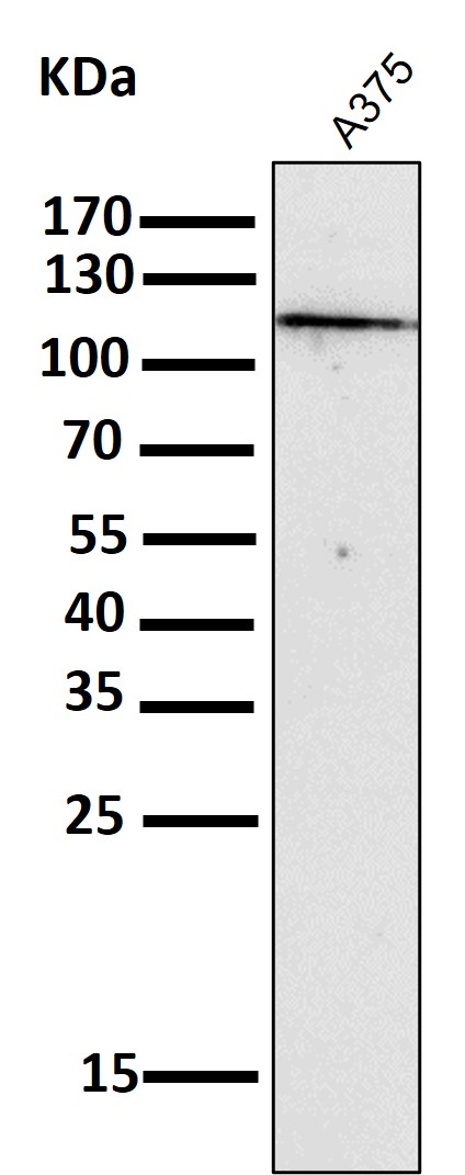 1 - Anti-NALP3 NLRP3 Rabbit Monoclonal Antibody ABO14373