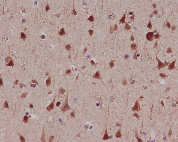 2 - Anti-Phospho-MSK1 (S376) RPS6KA5 Monoclonal Antibody ABO14374