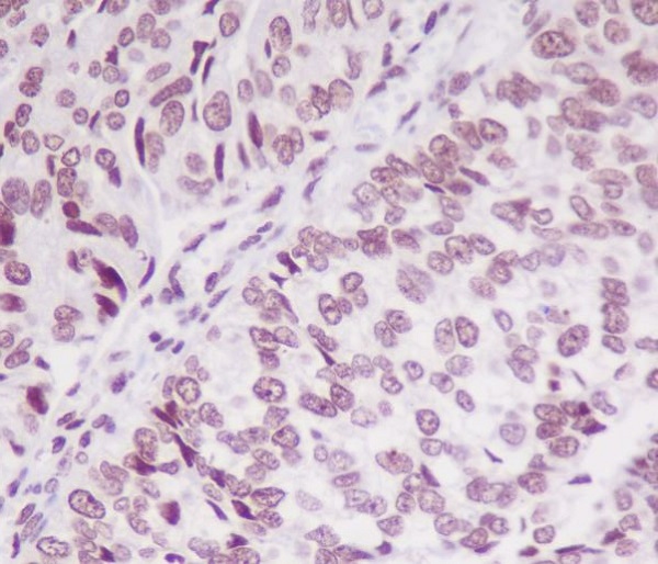 2 - Anti-Phospho-SMC1 (S957) Monoclonal Antibody ABO14375
