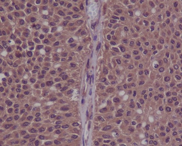 2 - Anti-Phospho-CDK2 (Y15) Rabbit Monoclonal Antibody ABO14377