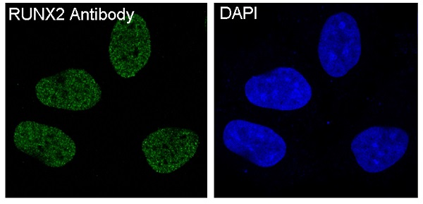 3 - Anti-RUNX2 Monoclonal Antibody ABO14378