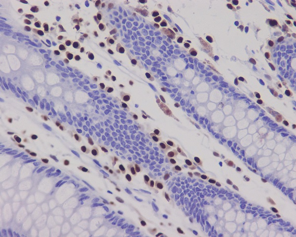 2 - Anti-RUNX2 Monoclonal Antibody ABO14378