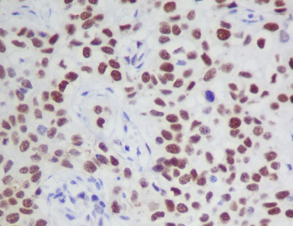 2 - Anti-Phospho-JAK2 (Y1007 + Y1008) Monoclonal Antibody ABO14379