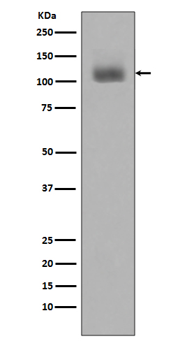 1 - Anti-Phospho-JAK2 (Y1007 + Y1008) Monoclonal Antibody ABO14379