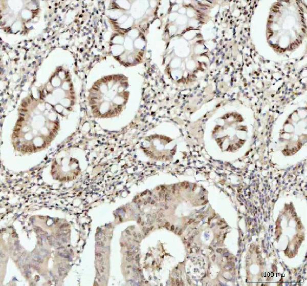 2 - Anti-Phospho-Histone H2A.X (S139) H2AFX Monoclonal Antibody ABO14380