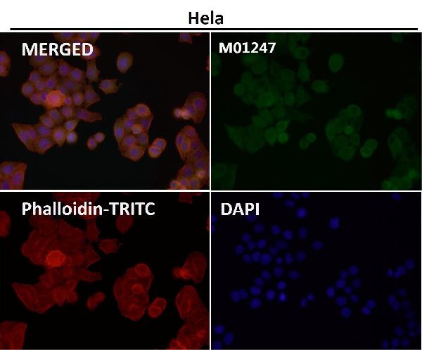 1 - Anti-IRAK4 Monoclonal Antibody ABO14385
