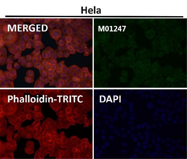 1 - Anti-IRAK4 Monoclonal Antibody ABO14385