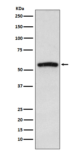 1 - Anti-IRAK4 Monoclonal Antibody ABO14385
