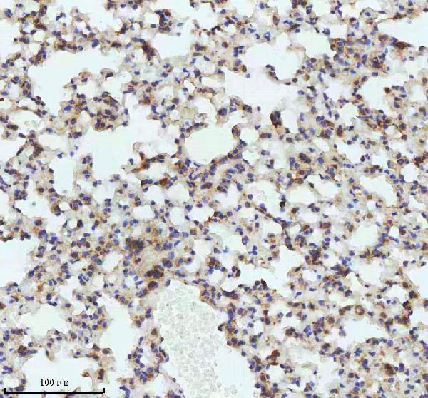 2 - Anti-LMO2 Monoclonal Antibody ABO14388