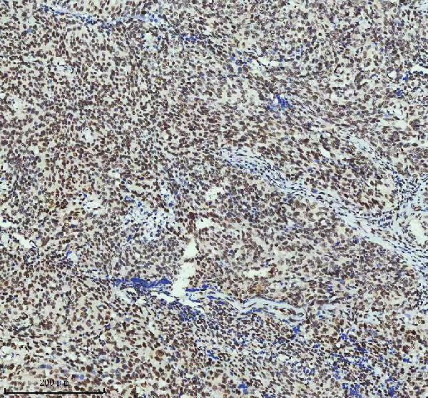 2 - Anti-MTA2 Monoclonal Antibody ABO14392
