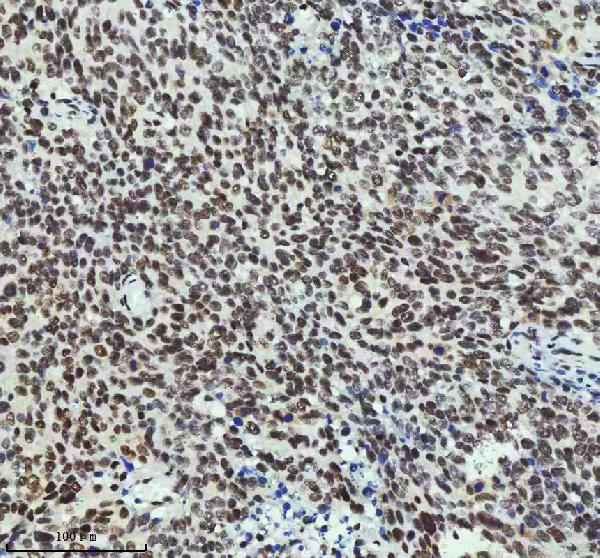 2 - Anti-MTA2 Monoclonal Antibody ABO14392