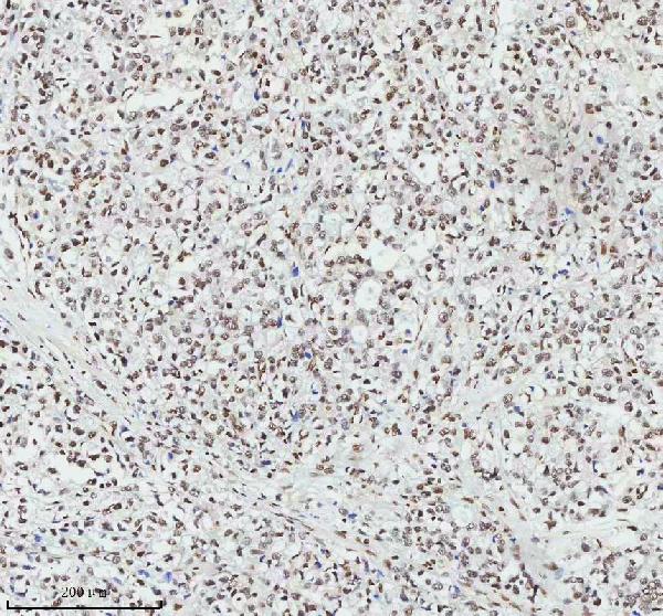2 - Anti-MTA2 Monoclonal Antibody ABO14392
