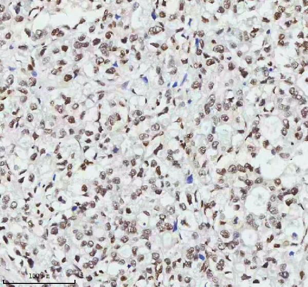 2 - Anti-MTA2 Monoclonal Antibody ABO14392