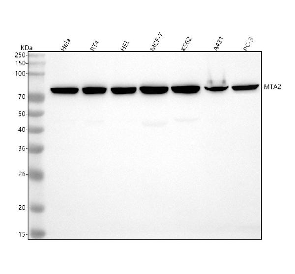 1 - Anti-MTA2 Monoclonal Antibody ABO14392